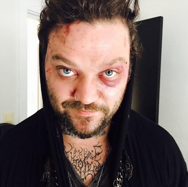 BAM MARGERA IS UNRECOGNISABLE COMPARED TO HIS 'JACKASS' DAYS!